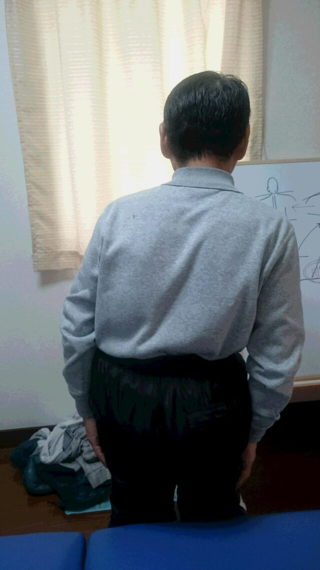 before画像