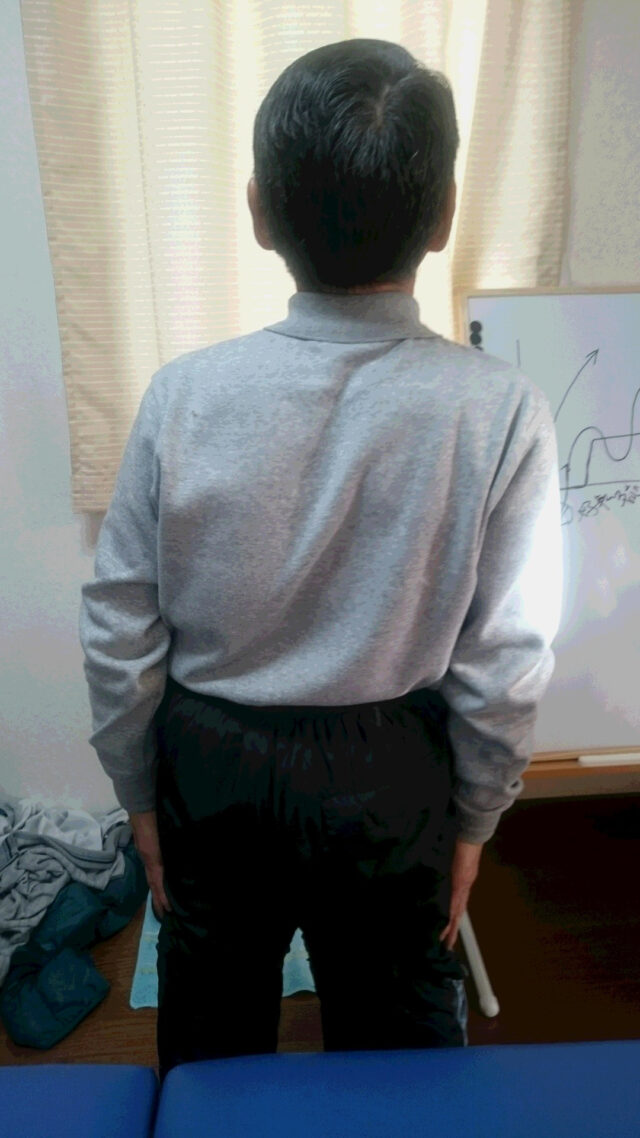 after画像