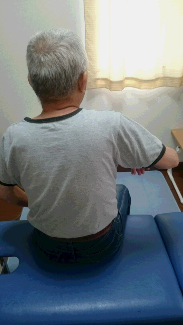 before画像